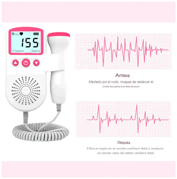 Monitor fetal de frecuencia cardiaca