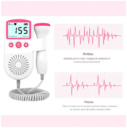 Monitor fetal de frecuencia cardiaca